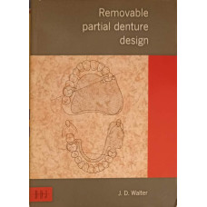 REMOVABLE PARTIAL DENTURE DESIGN