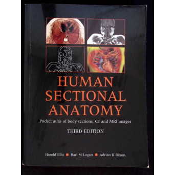 HUMAN SECTIONAL ANATOMY. POCKET ATLAS OF BODY SECTIONS, CT AND MRI IMAGES