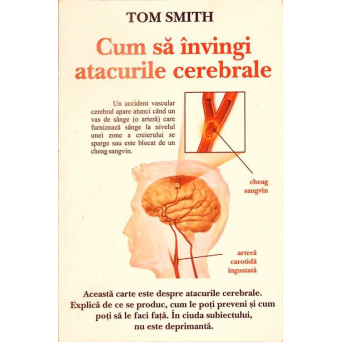 CUM SA INVINGI ATACURILE CEREBRALE