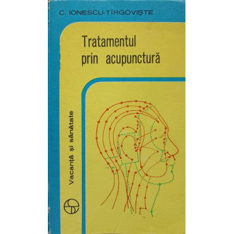 TRATAMENTUL PRIN ACUPUNCTURA