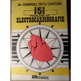 151 DE PROBLEME DE ELECTROCARDIOGRAFIE