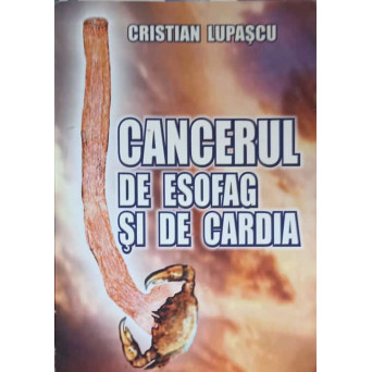 CANCERUL DE ESOFAG SI DE CARDIA