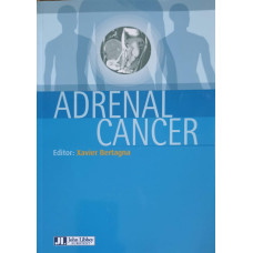 ADRENAL CANCER