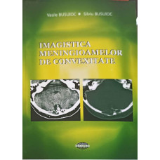 IMAGISTICA MENINGIOAMELOR DE CONVEXITATE