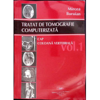 TRATAT DE TOMOGRAFIE COMPUTERIZATA VOL.1 CAP, COLOANA VERTEBRALA TRATAT DE TOMOGRAFIE COMPUTERIZATA VOL.1 CAP, COLOANA VERTEBRALA