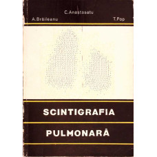 SCINTIGRAFIA PULMONARA