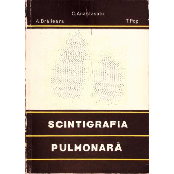 SCINTIGRAFIA PULMONARA