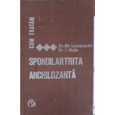 CUM TRATAM SPONDILARTRITA ANCHILOZANTA