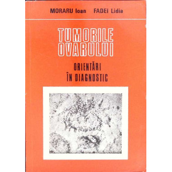 TUMORILE OVARULUI. ORIENTARI IN DIAGNOSTIC