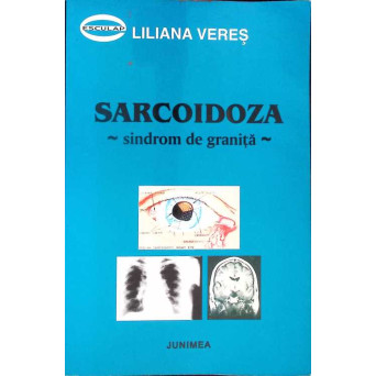 SARCOIDOZA: SINDROM DE GRANITA