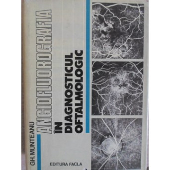 ANGIOFLUOROGRAFIA IN DIAGNOSTICUL OFTALMOLOGIC