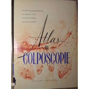 ATLAS DE COLPOSCOPIE