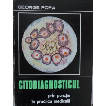 CITODIAGNOSTICUL PRIN PUNCTIE IN PRACTICA MEDICALA