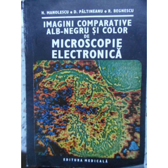IMAGINI COMPARATIVE ALB-NEGRU SI COLOR DE MICROSCOPIE ELECTRONICA