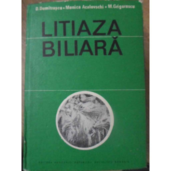 LITIAZA BILIARA