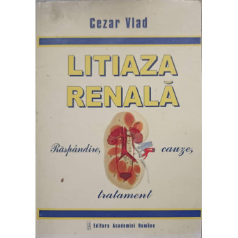 LITIAZA RENALA. RASPANDIRE, CAUZE, TRATAMENT