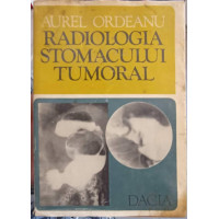 RADIOLOGIA STOMACULUI TUMORAL RADIOLOGIA STOMACULUI TUMORAL