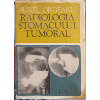 RADIOLOGIA STOMACULUI TUMORAL