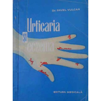URTICARIA SI ECZEMA