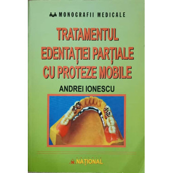 TRATAMENTUL EDENTATIEI PARTIALE CU PROTEZE MOBILE