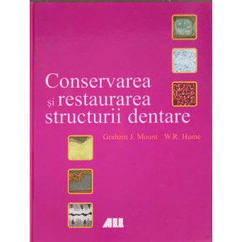 CONSERVAREA SI RESTAURAREA STRUCTURII DENTARE