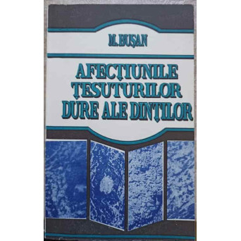 AFECTIUNILE TESUTURILOR DURE ALE DINTILOR