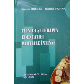 CLINICA SI TERAPIA EDENTATIEI PARTIALE INTINSE