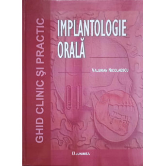 IMPLANTOLOGIE ORALA. GHID CLINIC SI PRACTIC