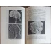 CELULELE LEUCEMICE. CITOLOGIE COMPARATA