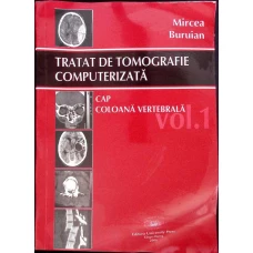 TRATAT DE TOMOGRAFIE COMPUTERIZATA VOL.1 CAP, COLOANA VERTEBRALA