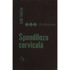 CUM TRATAM SPONDILOZA CERVICALA