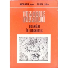 TUMORILE OVARULUI. ORIENTARI IN DIAGNOSTIC