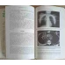 COMPUTED TOMOGRAPHY IN RADIATION THERAPY