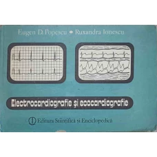ELECTROCARDIOGRAFIE SI ECOCARDIOGRAFIE