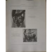 EXPLORATION RADIOLOGIQUE DES COLONS ET DE L'APPENDICE