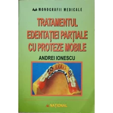 TRATAMENTUL EDENTATIEI PARTIALE CU PROTEZE MOBILE
