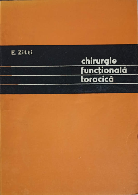 Vezi detalii pentru Chirurgie Functionala Toracica