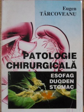 Patologie Chirurgicala. Esofag, Duoden, Stomac