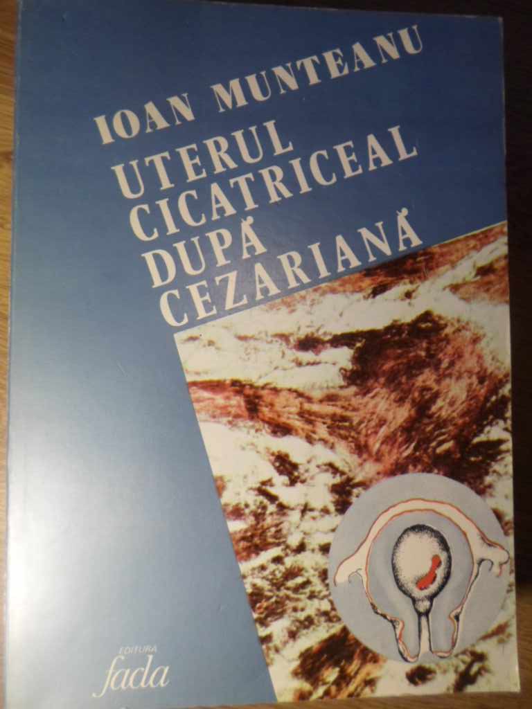 Vezi detalii pentru Uterul Cicatriceal Dupa Cezariana