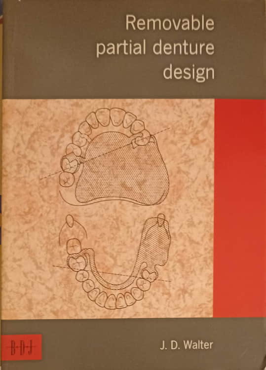 Vezi detalii pentru Removable Partial Denture Design