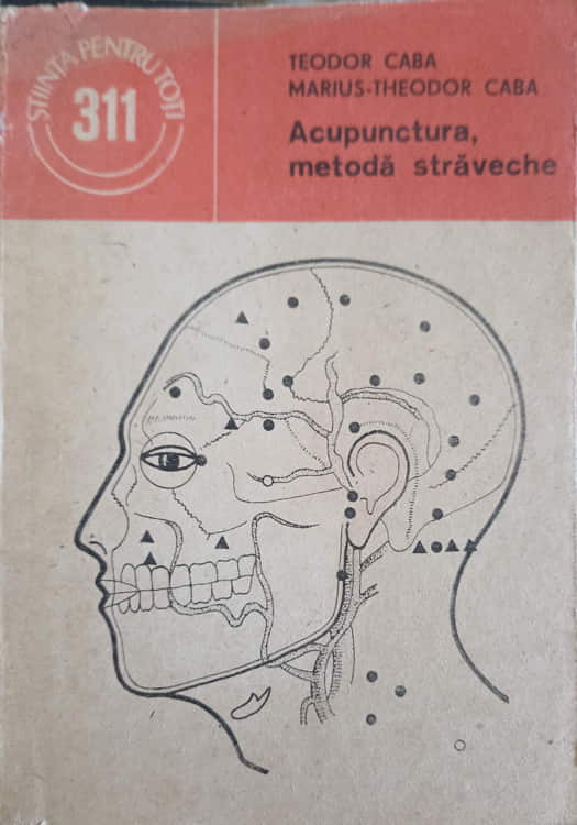 Acupunctura, Metoda Straveche