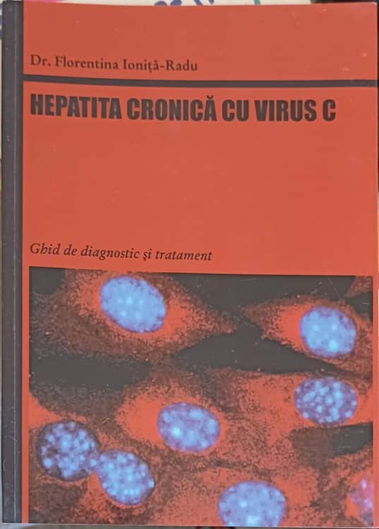 Vezi detalii pentru Hepatita Cronica Cu Virus C. Ghid De Diagnostic Si Tratament