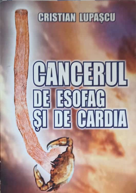 Vezi detalii pentru Cancerul De Esofag Si De Cardia