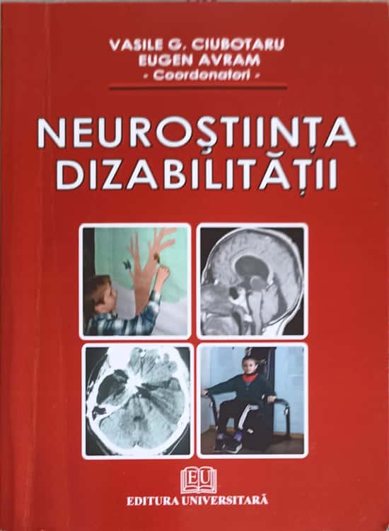 Vezi detalii pentru Neurostiinta Dizabilitatii