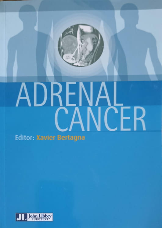 Vezi detalii pentru Adrenal Cancer