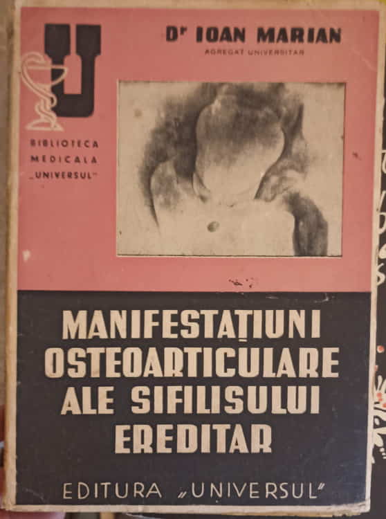 Vezi detalii pentru Manifestatiuni Osteoarticulare Ale Sifilisului Ereditar