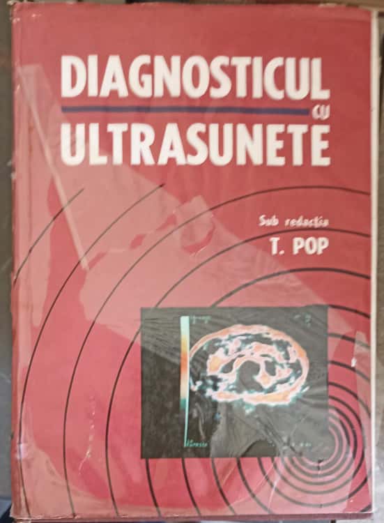 Vezi detalii pentru Diagnosticul Cu Ultrasunete