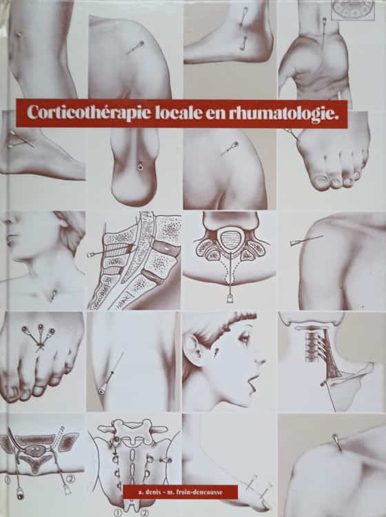 Vezi detalii pentru Corticotherapie Locale En Rhumatologie