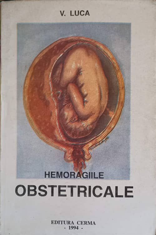 Vezi detalii pentru Hemoragiile Obstetricale