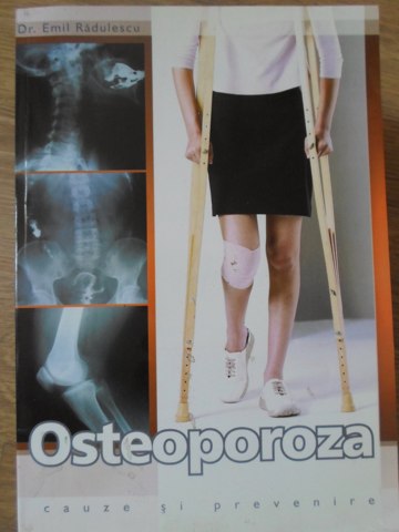 Osteoporoza Cauze Si Prevenire